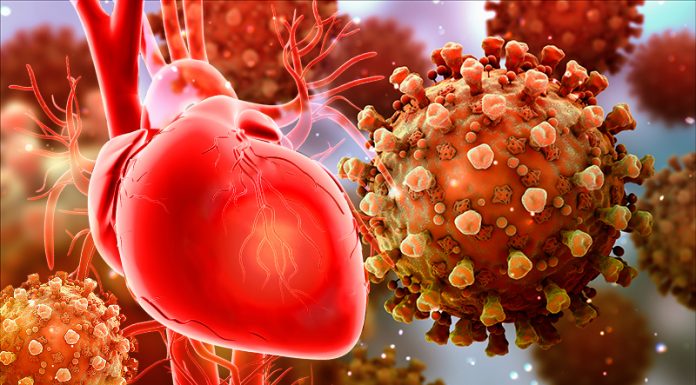 Torasik Aort Anevrizması